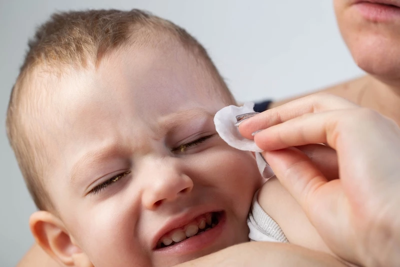 У ребенка гноятся глаза: причины и лечение