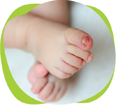 Лечение вросшего ногтя у детей