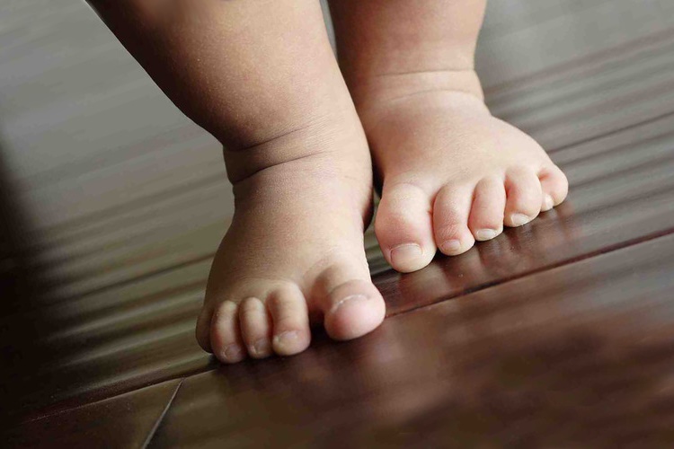 Симптомы плоскостопия у детей: как вовремя заподозрить?