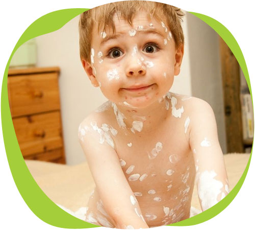Герпесвирусные инфекции у детей