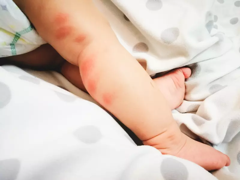 У ребенка чешутся красные пятна: причины, диагностика и лечение