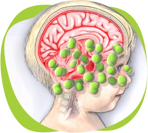 Защита ребенка от менингита