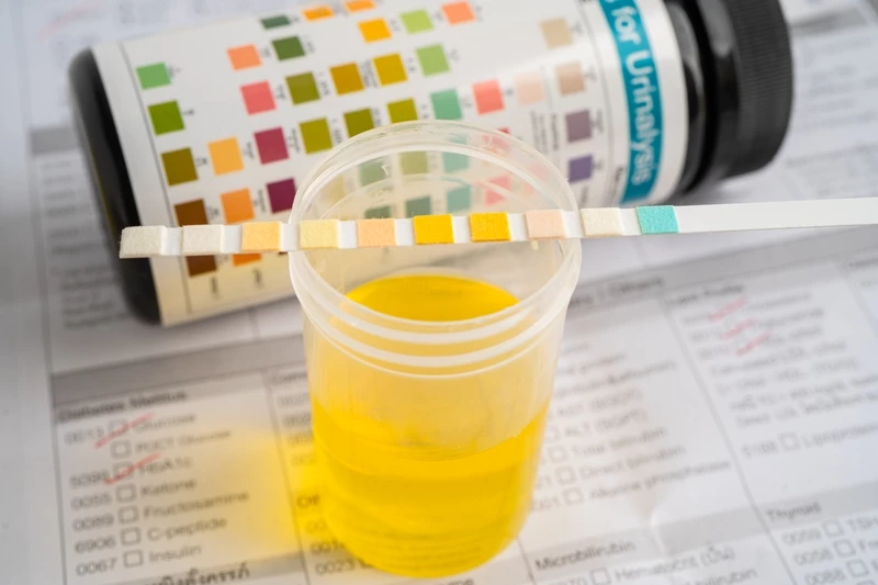 Норма мочи у ребенка: от новорожденности до подросткового возраста