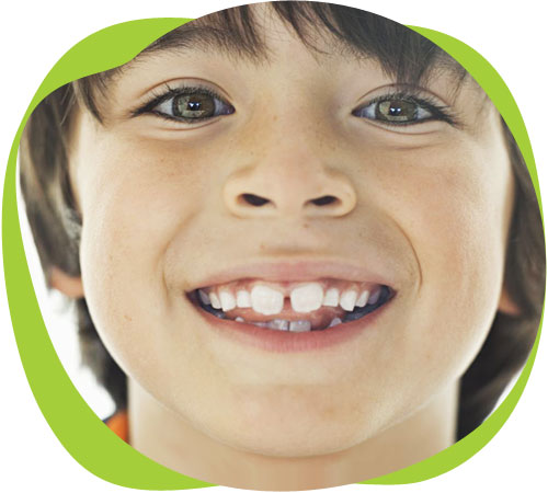 Реминерализация зубов у детей