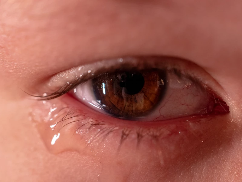 У ребенка слезятся глаза: причины и лечение