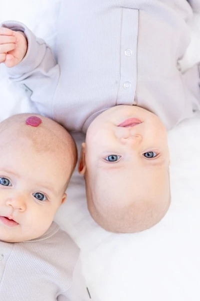 Гемангиома у детей: что это значит и что делать