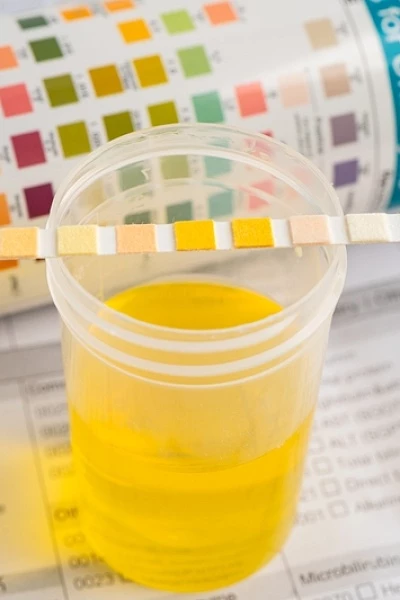 Норма мочи у ребенка: от новорожденности до подросткового возраста