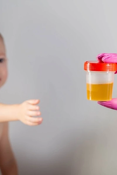 Бактерии в моче у ребенка: что это значит и что делать